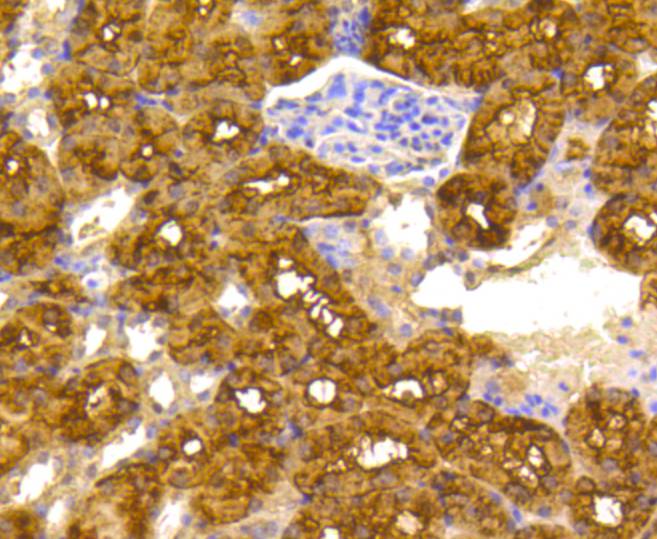 Immunohistochemical analysis of paraffin-embedded mouse kidney tissue using anti-ATP citrate lyase antibody. The section was pre-treated using heat mediated antigen retrieval with Tris-EDTA buffer (pH 8.0-8.4) for 20 minutes.The tissues were blocked in 5% BSA for 30 minutes at room temperature, washed with ddH2O and PBS, and then probed with the primary antibody (bsm-52458R, 1/50) for 30 minutes at room temperature. The detection was performed using an HRP conjugated compact polymer system. DAB was used as the chromogen. Tissues were counterstained with hematoxylin and mounted with DPX.