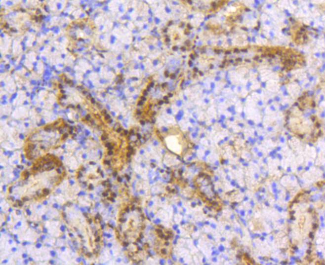 Immunohistochemical analysis of paraffin-embedded mouse thyroid tissue using anti-ATP citrate lyase antibody. The section was pre-treated using heat mediated antigen retrieval with Tris-EDTA buffer (pH 8.0-8.4) for 20 minutes.The tissues were blocked in 5% BSA for 30 minutes at room temperature, washed with ddH2O and PBS, and then probed with the primary antibody (bsm-52458R, 1/50) for 30 minutes at room temperature. The detection was performed using an HRP conjugated compact polymer system. DAB was used as the chromogen. Tissues were counterstained with hematoxylin and mounted with DPX.