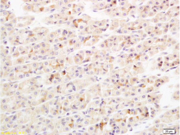 Formalin-fixed and paraffin embedded rat stomach tissue labeled with Anti-IL-17\/IL-17A Polyclonal Antibody, Unconjugated(bs-1183R) at 1:600 followed by conjugation to the secondary antibody and DAB staining
