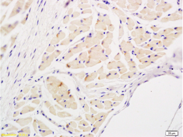Formalin-fixed and paraffin embedded rat tongue tissue labeled with Anti-IL-17\/IL-17A Polyclonal Antibody, Unconjugated(bs-1183R) at 1:600 followed by conjugation to the secondary antibody and DAB staining