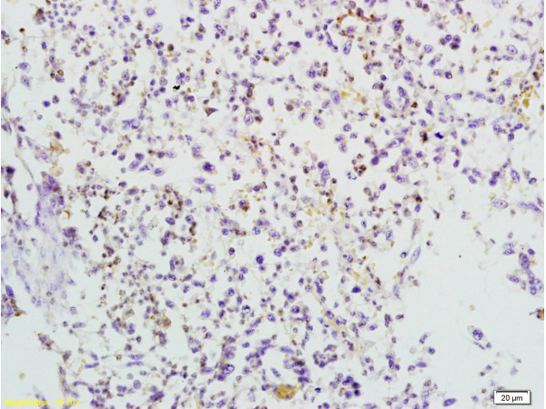 Formalin-fixed and paraffin embedded mouse lymphoma tissue labeled with Anti-TRAF3/CD40bp Polyclonal Antibody, Unconjugated (bs-1185R) at 1:200 followed by conjugation to the secondary antibody and DAB staining