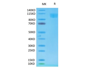 Recombinant Cyno ACE2 Protein, C-His-Avi (HEK293), Biotinylated, Biotin Conjugated