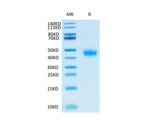 Biotinylated Recombinant Human CD122\/IL2RB Protein on Tris-Bis PAGE under reduced condition. The purity is greater than 95%.