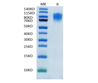 Biotinylated Recombinant CD30 Protein on Tris-Bis PAGE under reduced condition. The purity is greater than 95%.