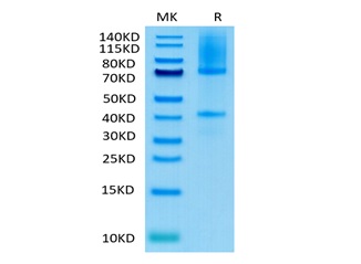 Biotinylated Human GPC3 on Tris-Bis PAGE under reduced condition. The purity is greater than 95%.