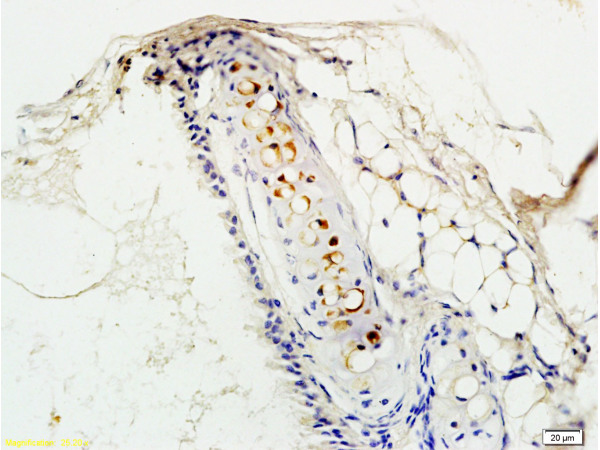 Formalin-fixed and rat lung tissue labeled with Anti-PTAFR Polyclonal Antibody, Unconjugated (bs-1478R) at 1:200 followed by conjugation to the secondary antibody and DAB staining