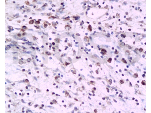 Formalin-fixed and paraffin embedded rat colon tissue labeled with Anti-PTAFR Polyclonal Antibody, Unconjugated (bs-1478R) at 1:200 followed by conjugation to the secondary antibody and DAB staining
