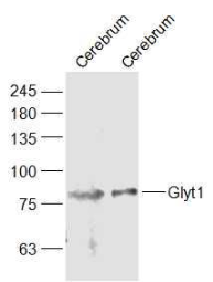 Lane 1: Mouse Cerebrum Lysates; Lane 2: Rat Cerebrum Lysates. Probed with Glyt1/SLC6A9 Polyclonal Antibody, unconjugated (bs-11604R) at 1:1000 dilution and 4°C overnight incubation. Followed by conjugated secondary antibody incubation at 1:20000 for 60 min at 37˚C.