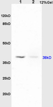 L1 rat lung lysates, L2 rat brain lysates probed (bs-1478R) Anti-PTAFR Polyclonal, Unconjugated at 1:200 in 4˚C. Followed by conjugation to secondary antibody (bs-0295G-HRP) at 1:3000 90min in 37˚C. Predicted band and observed band siz