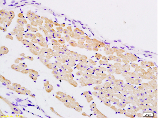 Formalin-fixed and paraffin embedded rat heart tissue labeled with Anti-PER2/Period circadian protein 2 Polyclonal Antibody, Unconjugated (bs-3927R) at 1:200 followed by conjugation to the secondary antibody and DAB staining