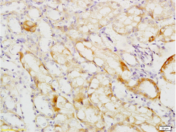 Formalin-fixed and paraffin embedded mouse kidney tissue labeled with Anti-MCKD2/UMOD Polyclonal Antibody, Unconjugated (bs-2189R) at 1:200 followed by conjugation to the secondary antibody and DAB staining