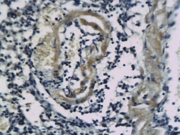 Formalin-fixed and paraffin embedded mouse lung tissue labeled with Anti-SSTR2 Polyclonal Antibody, Unconjugated (bs-1138R)  followed by conjugation to the secondary antibody and DAB staining