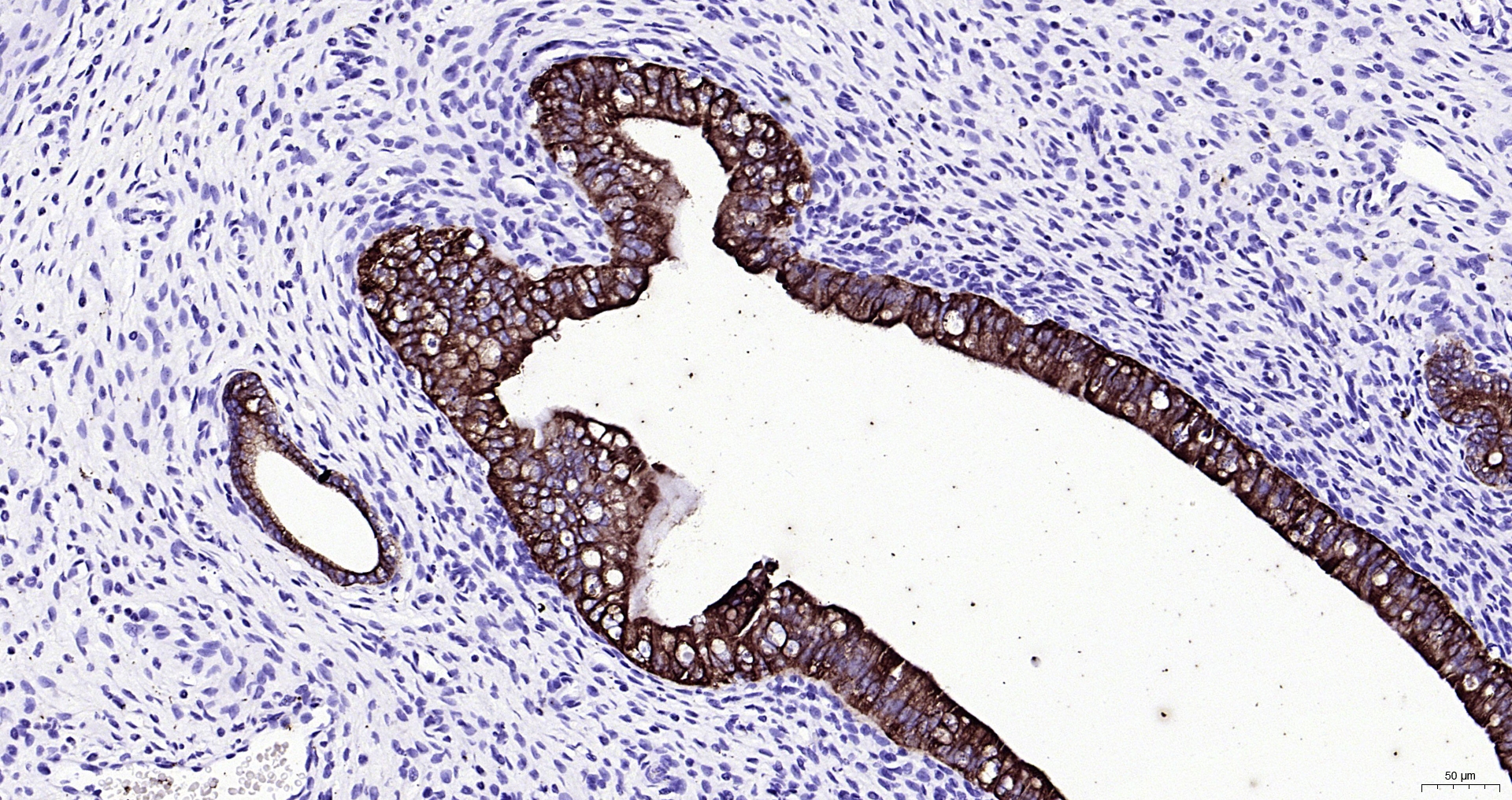 Paraformaldehyde-fixed, paraffin embedded (rat uterus); Antigen retrieval by boiling in sodium citrate buffer (pH6.0) for 15min; Block endogenous peroxidase by 3% hydrogen peroxide for 20 minutes; Blocking buffer (normal goat serum) at 37°C for 30min; Antibody incubation with (CK16) Monoclonal Antibody, Unconjugated (ascites of bsm-33062M 8H6) at 1:2000 overnight at 4°C, followed by operating according to SP Kit(Mouse) (sp-0024) instructions and DAB staining.
