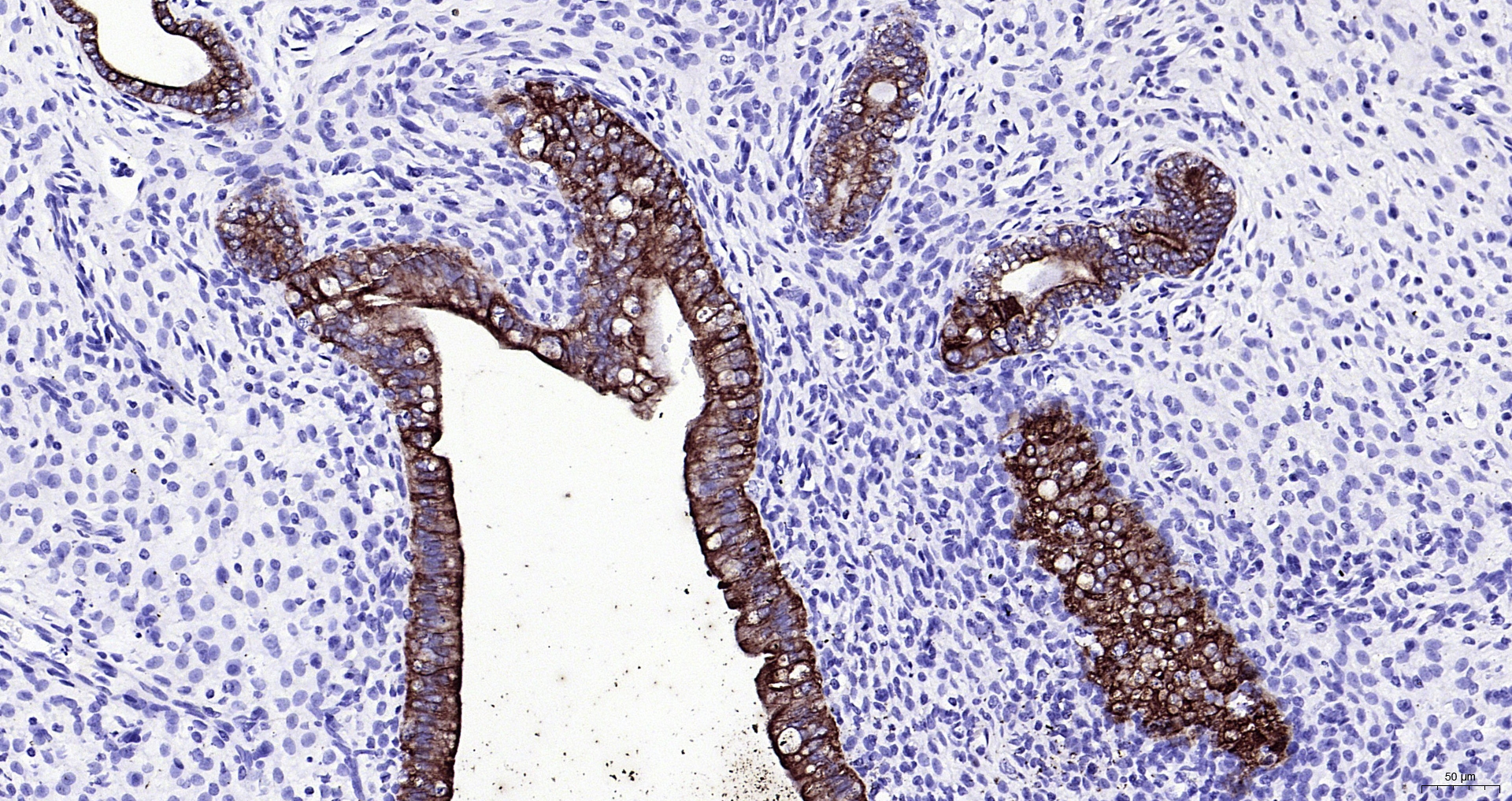 Paraformaldehyde-fixed, paraffin embedded (rat uterus); Antigen retrieval by boiling in sodium citrate buffer (pH6.0) for 15min; Block endogenous peroxidase by 3% hydrogen peroxide for 20 minutes; Blocking buffer (normal goat serum) at 37°C for 30min; Antibody incubation with (CK16) Monoclonal Antibody, Unconjugated (ascites of bsm-33062M 8H6) at 1:2000 overnight at 4°C, followed by operating according to SP Kit(Mouse) (sp-0024) instructions and DAB staining.