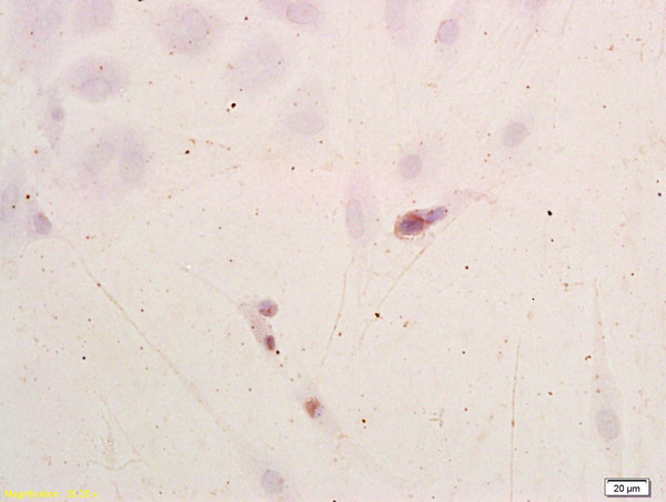 Neuroblastoma cells labeled with Anti-NSE\/ENO2\/\u03b3 Enolase Polyclonal Antibody, Unconjugated (bs-1027R) at 1:200, followed by conjugation to the secondary antibody