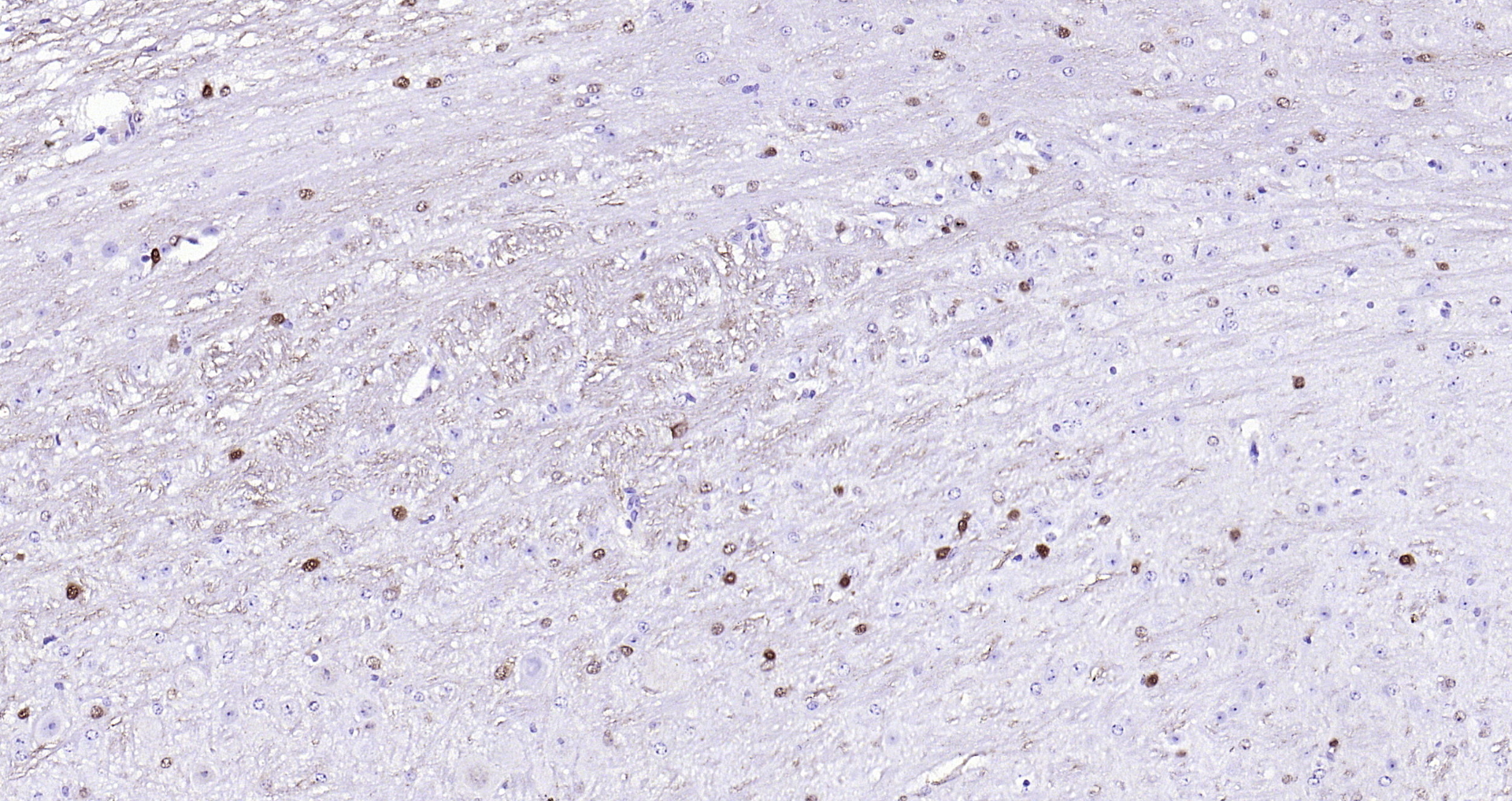 Paraformaldehyde-fixed, paraffin embedded (mouse cerebellum); Antigen retrieval by boiling in sodium citrate buffer (pH6.0) for 15min; Block endogenous peroxidase by 3% hydrogen peroxide for 20 minutes; Blocking buffer (normal goat serum) at 37°C for 30min; Antibody incubation with (S100B) Monoclonal Antibody, Unconjugated (bsm-10832M) at 1:200 overnight at 4°C, followed by operating according to SP Kit(Mouse)(sp-0024 bs-0296G-HRP 1:300) instructionsand DAB staining.