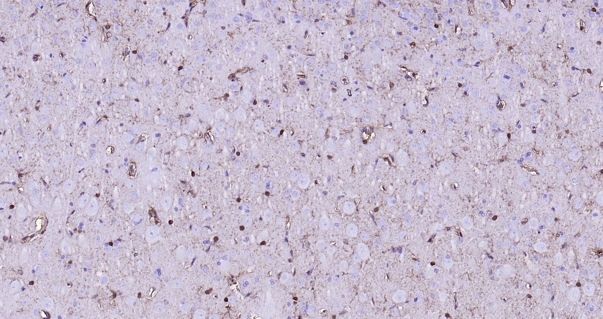 Paraformaldehyde-fixed, paraffin embedded (rat brain); Antigen retrieval by boiling in sodium citrate buffer (pH6.0) for 15min; Block endogenous peroxidase by 3% hydrogen peroxide for 20 minutes; Blocking buffer (normal goat serum) at 37°C for 30min; Antibody incubation with (S100B) Monoclonal Antibody, Unconjugated (bsm-10832M) at 1:200 overnight at 4°C, followed by operating according to SP Kit(Mouse)(sp-0024 bs-0296G-HRP 1:100) instructionsand DAB staining.