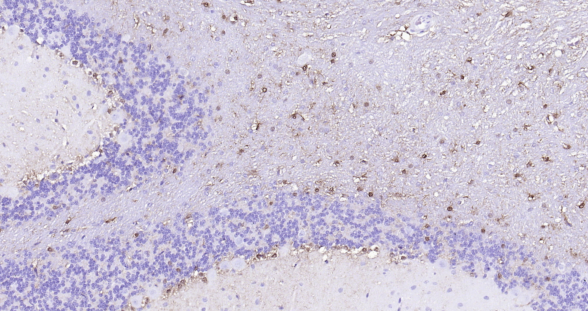 Paraformaldehyde-fixed, paraffin embedded (rat cerebellum); Antigen retrieval by boiling in sodium citrate buffer (pH6.0) for 15min; Block endogenous peroxidase by 3% hydrogen peroxide for 20 minutes; Blocking buffer (normal goat serum) at 37°C for 30min; Antibody incubation with (S100B) Monoclonal Antibody, Unconjugated (bsm-10832M) at 1:200 overnight at 4°C, followed by operating according to SP Kit(Mouse)(sp-0024 bs-0296G-HRP 1:300) instructionsand DAB staining.