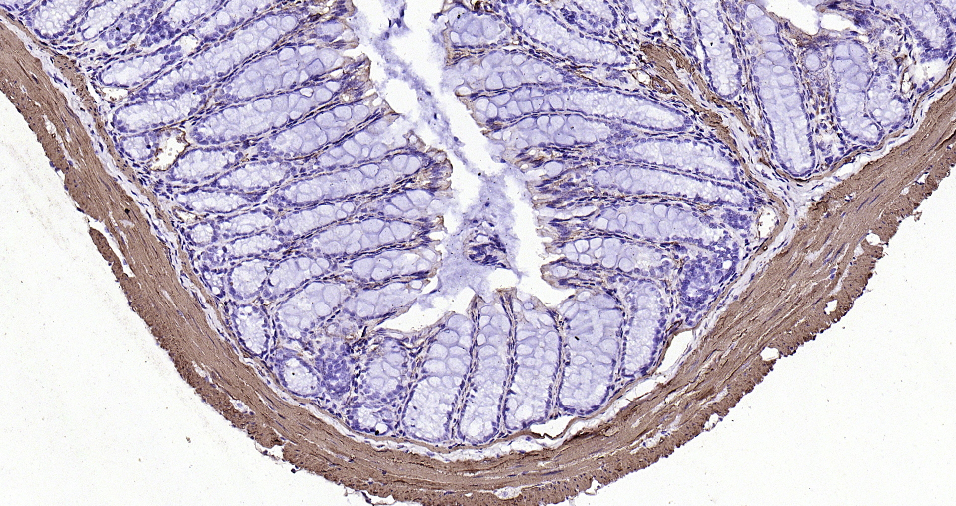 Goat Anti-Mouse IgG Antibody (H+L), HRP Conjugated – Bioss