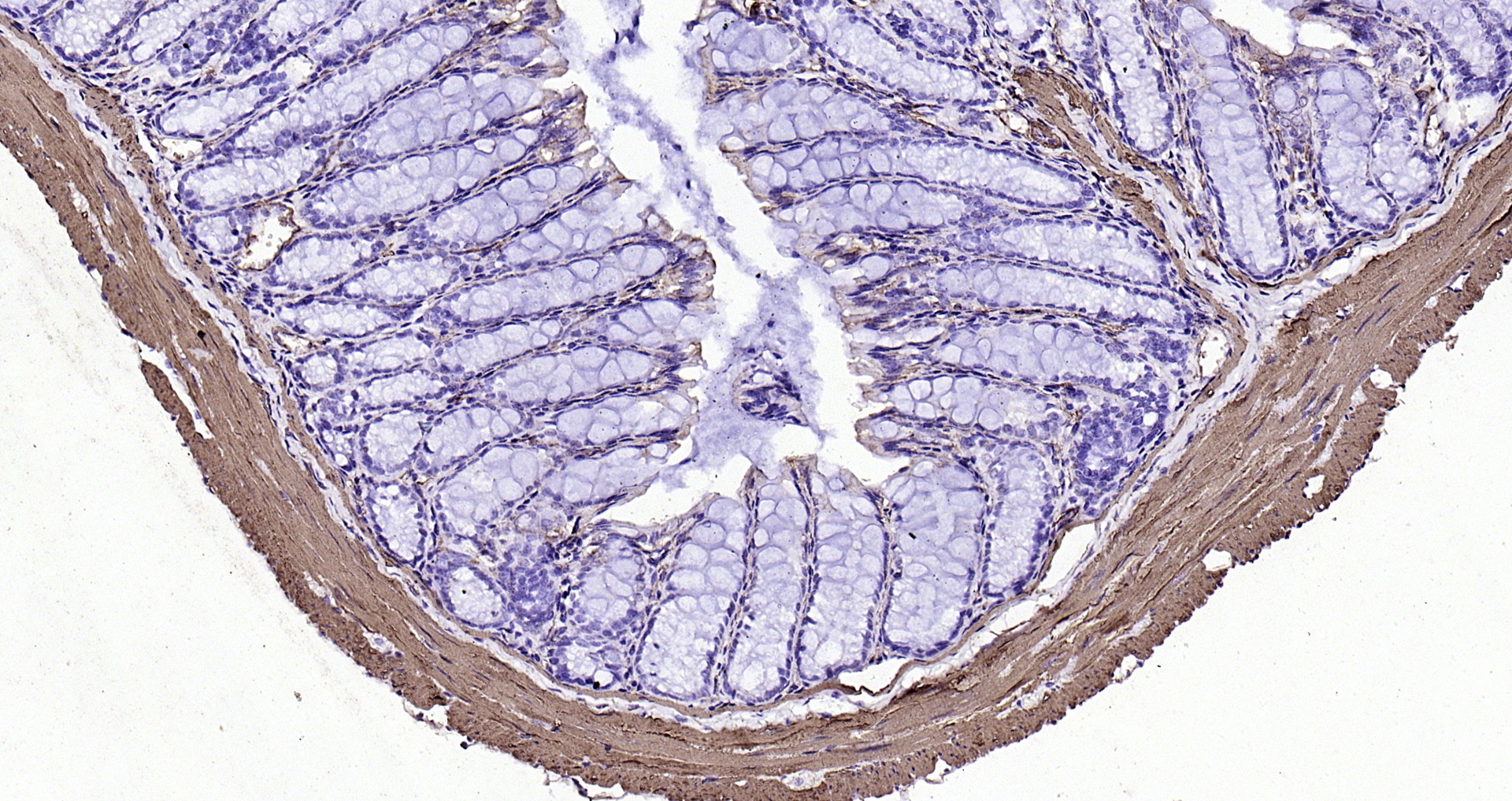 Paraformaldehyde-fixed, paraffin embedded (mouse colon); Antigen retrieval by boiling in sodium citrate buffer (pH6.0) for 15min; Block endogenous peroxidase by 3% hydrogen peroxide for 20 minutes; Blocking buffer (normal goat serum) at 37°C for 30min; Antibody incubation with (alpha smooth muscle Actin) Monoclonal Antibody, Unconjugated (bsm-33187M) at 1:200 overnight at 4°C, followed by operating according to SP Kit(Mouse)(sp-0024 bs-0296G-HRP 1:300) instructionsand DAB staining.