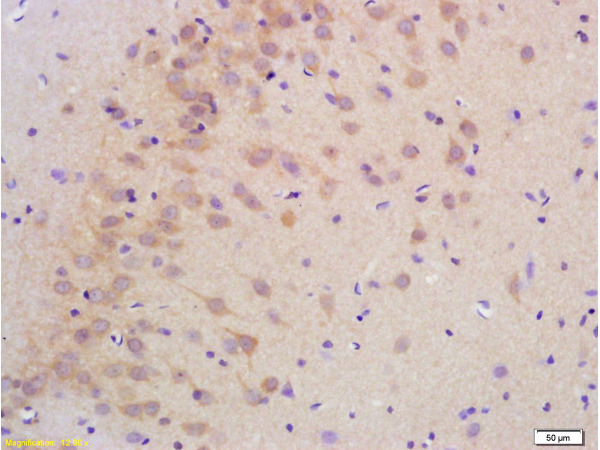 Formalin-fixed and paraffin embedded rat brain labeled with Anti-PHOSPHO-LLGL1 + LLGL2(SER650+SER654) Antibody, Unconjugated (bs-6070R) at 1:200 followed by conjugation to the secondary antibody and DAB staining