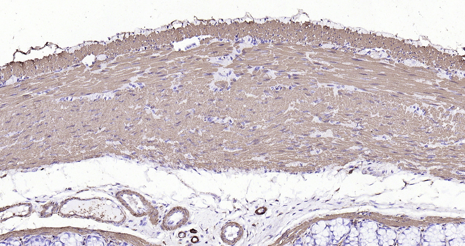 Paraformaldehyde-fixed, paraffin embedded (rat colon); Antigen retrieval by boiling in sodium citrate buffer (pH6.0) for 15min; Block endogenous peroxidase by 3% hydrogen peroxide for 20 minutes; Blocking buffer (normal goat serum) at 37°C for 30min; Antibody incubation with (alpha smooth muscle Actin) Monoclonal Antibody, Unconjugated (bsm-33187M) at 1:200 overnight at 4°C, followed by operating according to SP Kit(Mouse)(sp-0024 bs-0296G-HRP 1:300) instructionsand DAB staining.