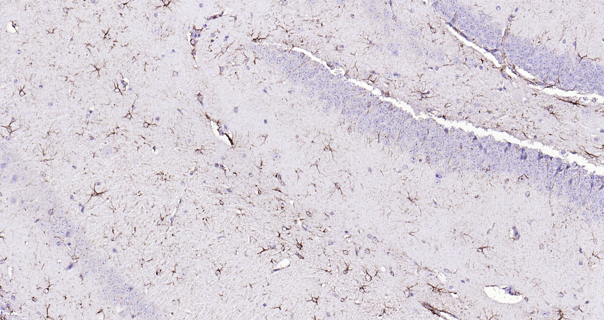 Paraformaldehyde-fixed, paraffin embedded (mouse brain); Antigen retrieval by boiling in sodium citrate buffer (pH6.0) for 15min; Block endogenous peroxidase by 3% hydrogen peroxide for 20 minutes; Blocking buffer (normal goat serum) at 37°C for 30min; Antibody incubation with (GFAP) Polyclonal Antibody, Unconjugated (bs-0199R) at 1:200 overnight at 4°C, followed by operating according to SP Kit(Rabbit) (sp-0023 bs-0295G-HRP 1:300) instructionsand DAB staining.