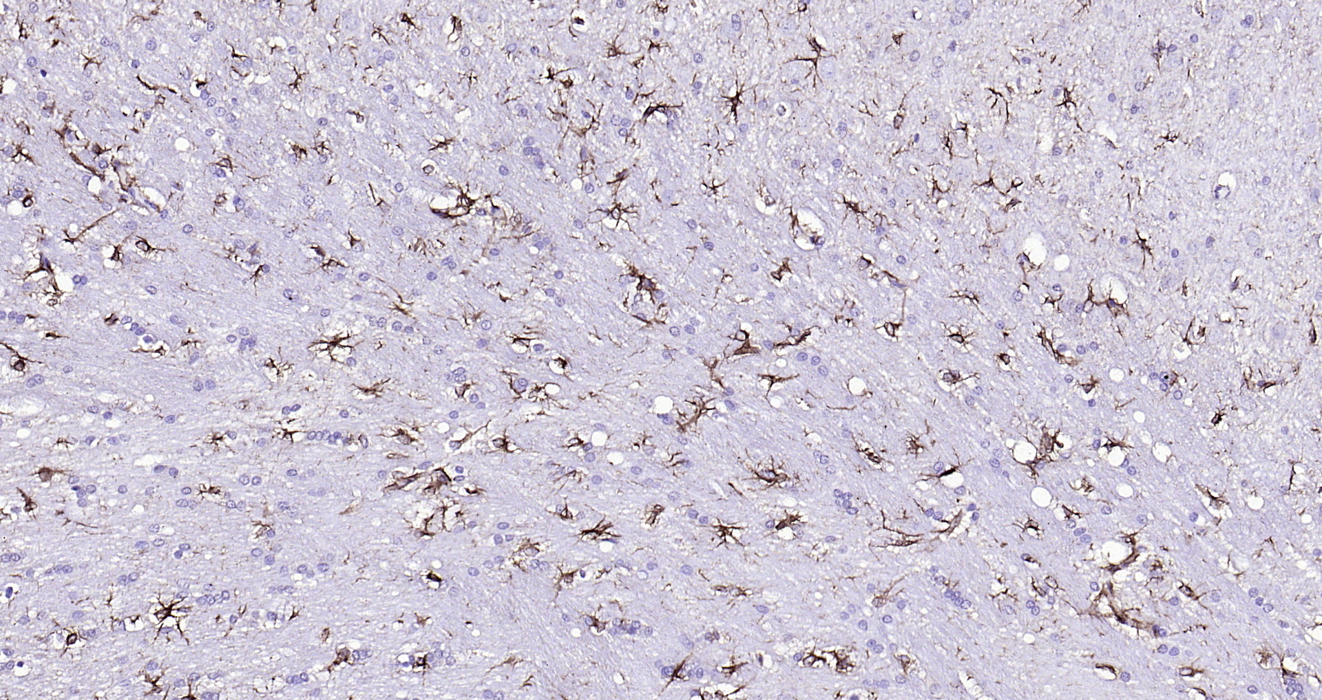 Paraformaldehyde-fixed, paraffin embedded (rat brain); Antigen retrieval by boiling in sodium citrate buffer (pH6.0) for 15min; Block endogenous peroxidase by 3% hydrogen peroxide for 20 minutes; Blocking buffer (normal goat serum) at 37°C for 30min; Antibody incubation with (GFAP) Polyclonal Antibody, Unconjugated (bs-0199R) at 1:200 overnight at 4°C, followed by operating according to SP Kit(Rabbit) (sp-0023 bs-0295G-HRP 1:300) instructionsand DAB staining.