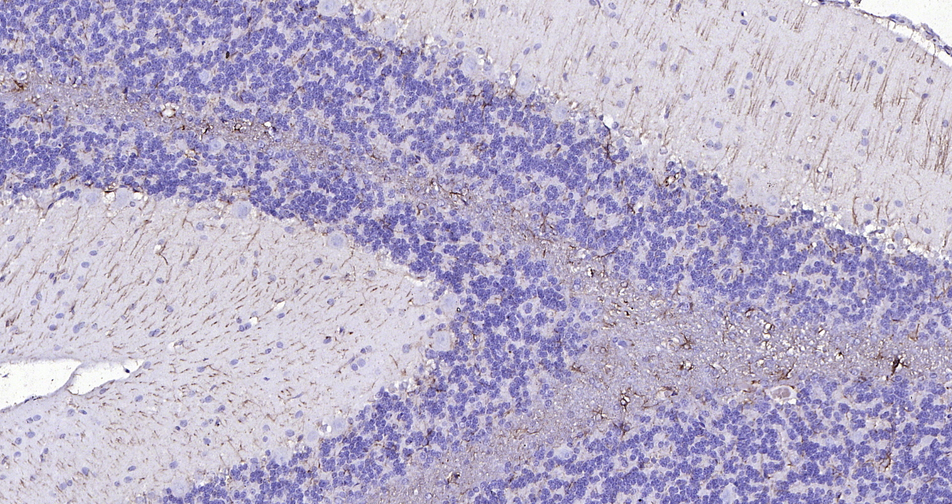 Paraformaldehyde-fixed, paraffin embedded (rat cerebellum); Antigen retrieval by boiling in sodium citrate buffer (pH6.0) for 15min; Block endogenous peroxidase by 3% hydrogen peroxide for 20 minutes; Blocking buffer (normal goat serum) at 37°C for 30min; Antibody incubation with (GFAP) Polyclonal Antibody, Unconjugated (bs-0199R) at 1:200 overnight at 4°C, followed by operating according to SP Kit(Rabbit) (sp-0023 bs-0295G-HRP 1:300) instructionsand DAB staining.
