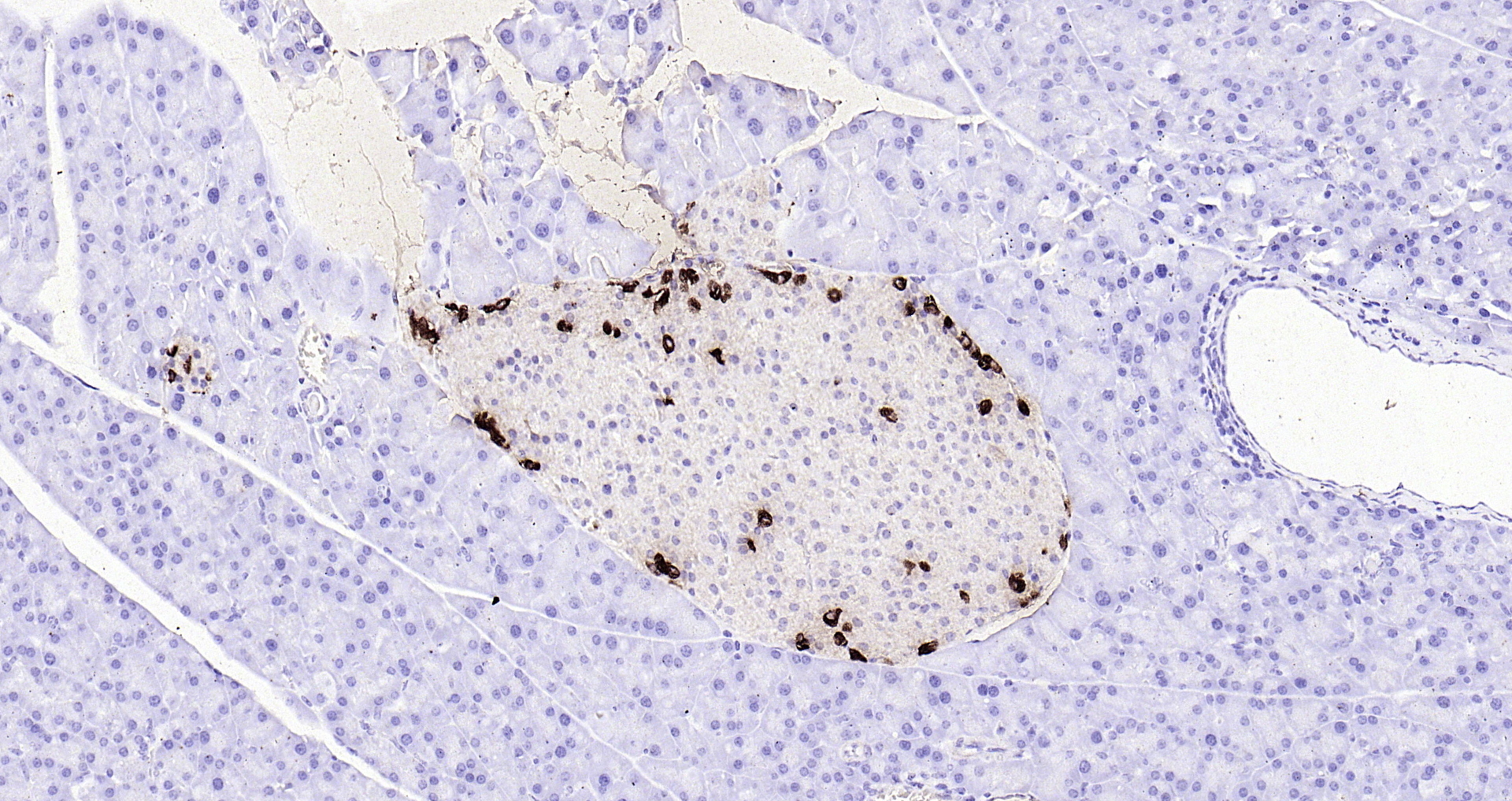 Paraformaldehyde-fixed, paraffin embedded (mouse pancreas); Antigen retrieval by boiling in sodium citrate buffer (pH6.0) for 15min; Block endogenous peroxidase by 3% hydrogen peroxide for 20 minutes; Blocking buffer (normal goat serum) at 37°C for 30min; Antibody incubation with (Glucagon) Polyclonal Antibody, Unconjugated (bs-3796R) at 1:200 overnight at 4°C, followed by operating according to SP Kit(Rabbit) (sp-0023 bs-0295G-HRP 1:300) instructionsand DAB staining.