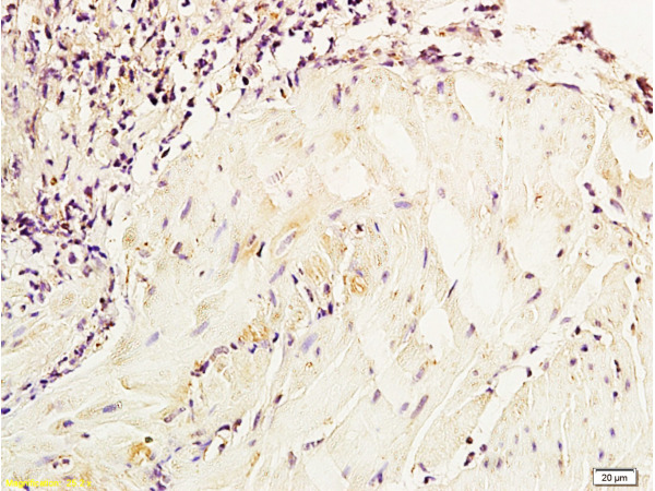 Formalin-fixed and paraffin embedded dog bladder tissue labeled with Anti-NSE\/ENO2\/\u03b3 Enolase Polyclonal Antibody, Unconjugated (bs-1027R) at 1:800, followed by conjugation to the secondary antibody and DAB staining