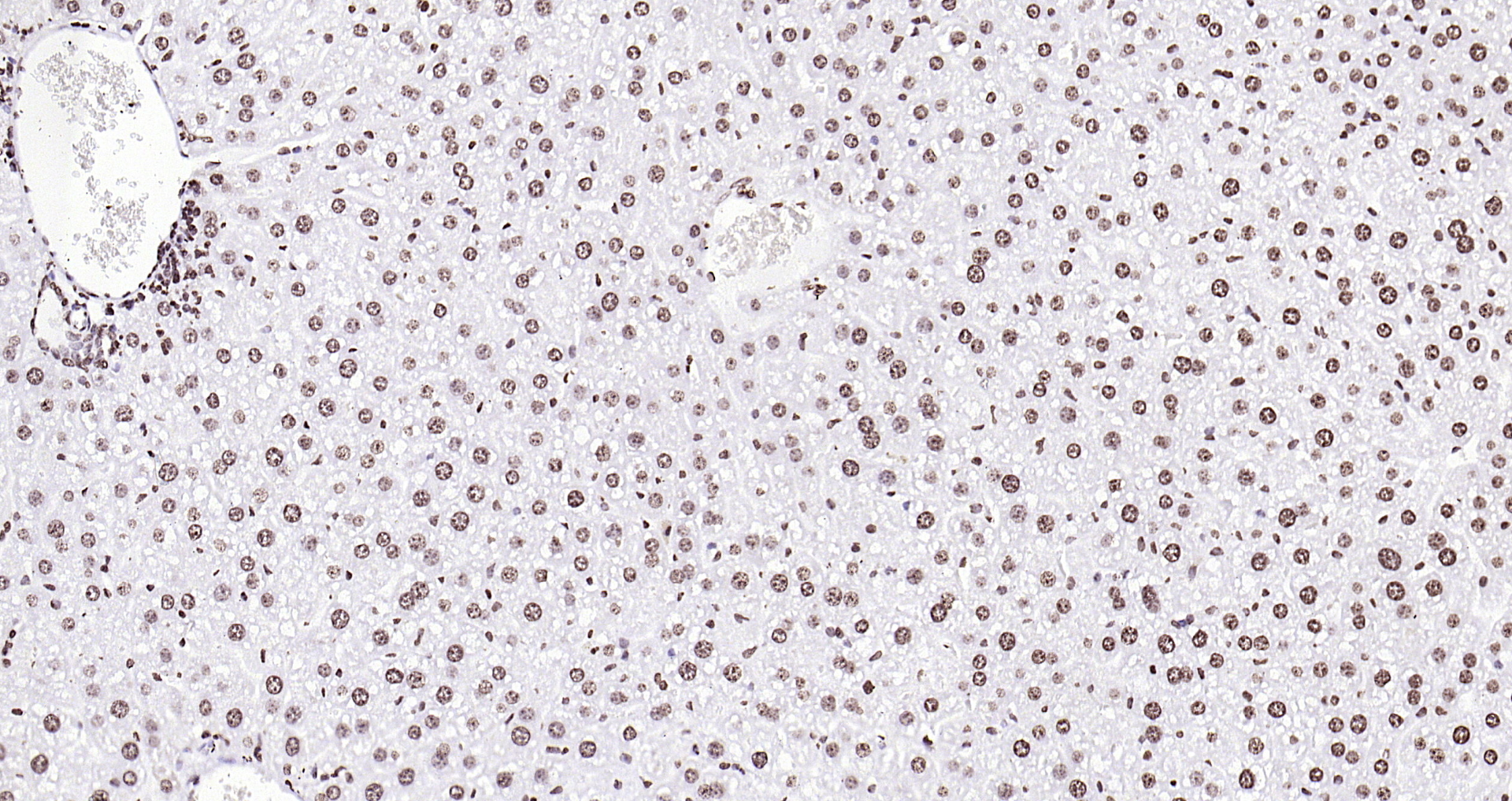 Paraformaldehyde-fixed, paraffin embedded (mouse liver); Antigen retrieval by boiling in sodium citrate buffer (pH6.0) for 15min; Block endogenous peroxidase by 3% hydrogen peroxide for 20 minutes; Blocking buffer (normal goat serum) at 37°C for 30min; Antibody incubation with (Histone H3 (Nuclear Loading Control)) Polyclonal Antibody, Unconjugated (bs-0349R) at 1:200 overnight at 4°C, followed by operating according to SP Kit(Rabbit) (sp-0023 bs-0295G-HRP 1:100) instructionsand DAB staining.