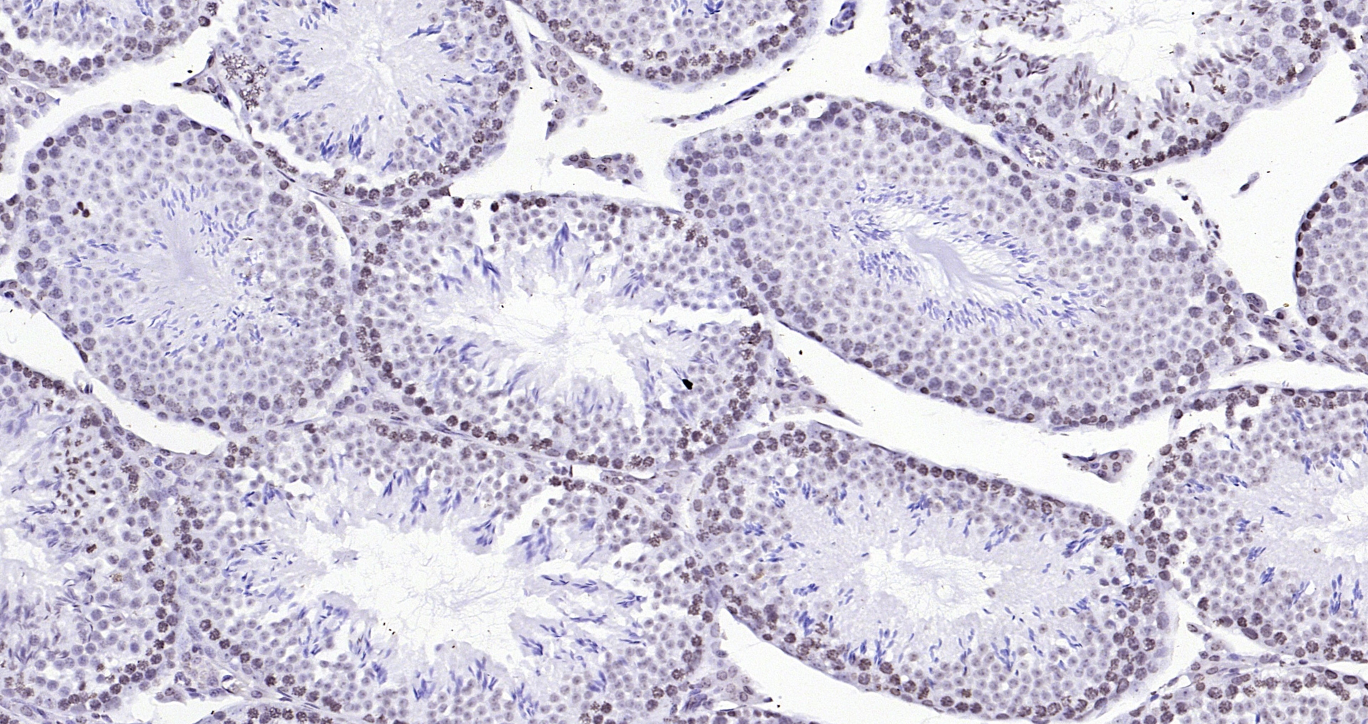 Paraformaldehyde-fixed, paraffin embedded (mouse testis); Antigen retrieval by boiling in sodium citrate buffer (pH6.0) for 15min; Block endogenous peroxidase by 3% hydrogen peroxide for 20 minutes; Blocking buffer (normal goat serum) at 37°C for 30min; Antibody incubation with (Histone H3 (Nuclear Loading Control)) Polyclonal Antibody, Unconjugated (bs-0349R) at 1:200 overnight at 4°C, followed by operating according to SP Kit(Rabbit) (sp-0023 bs-0295G-HRP 1:100) instructionsand DAB staining.