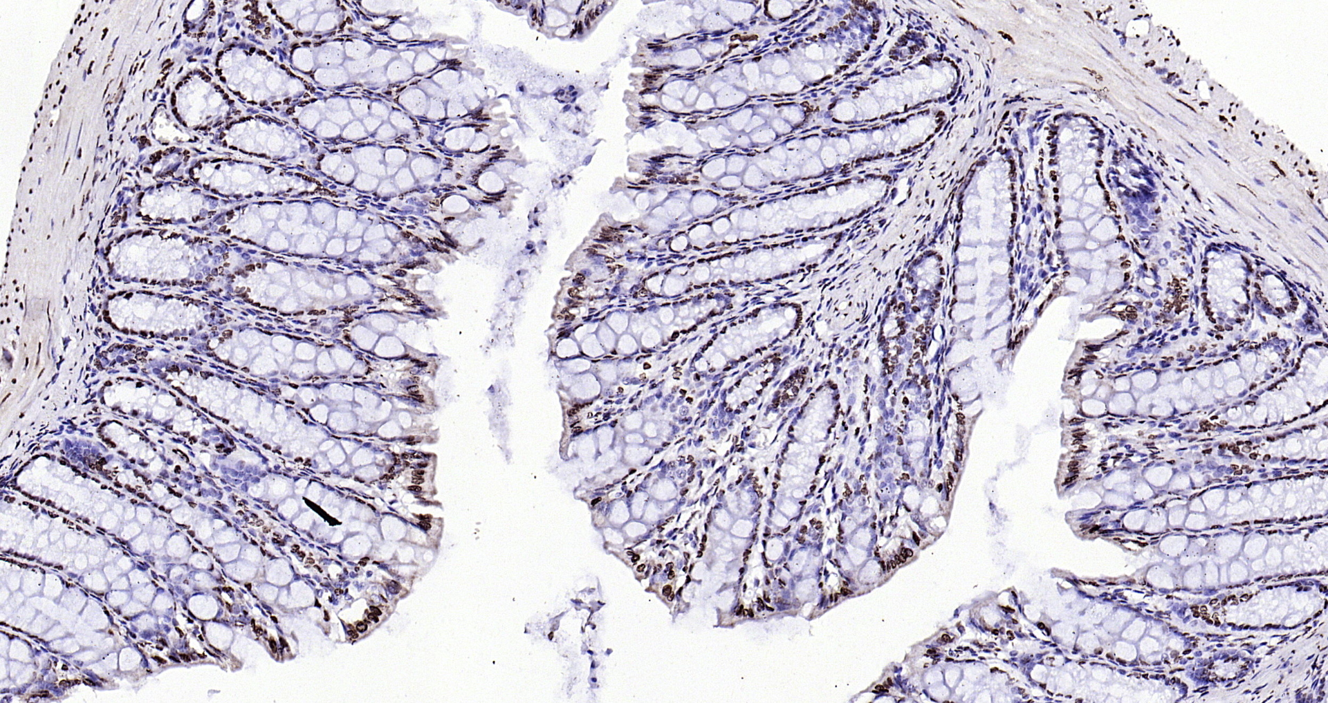 Paraformaldehyde-fixed, paraffin embedded (mouse colon); Antigen retrieval by boiling in sodium citrate buffer (pH6.0) for 15min; Block endogenous peroxidase by 3% hydrogen peroxide for 20 minutes; Blocking buffer (normal goat serum) at 37°C for 30min; Antibody incubation with (Histone H3 (Nuclear Loading Control)) Polyclonal Antibody, Unconjugated (bs-0349R) at 1:200 overnight at 4°C, followed by operating according to SP Kit(Rabbit) (sp-0023 bs-0295G-HRP 1:100) instructionsand DAB staining.