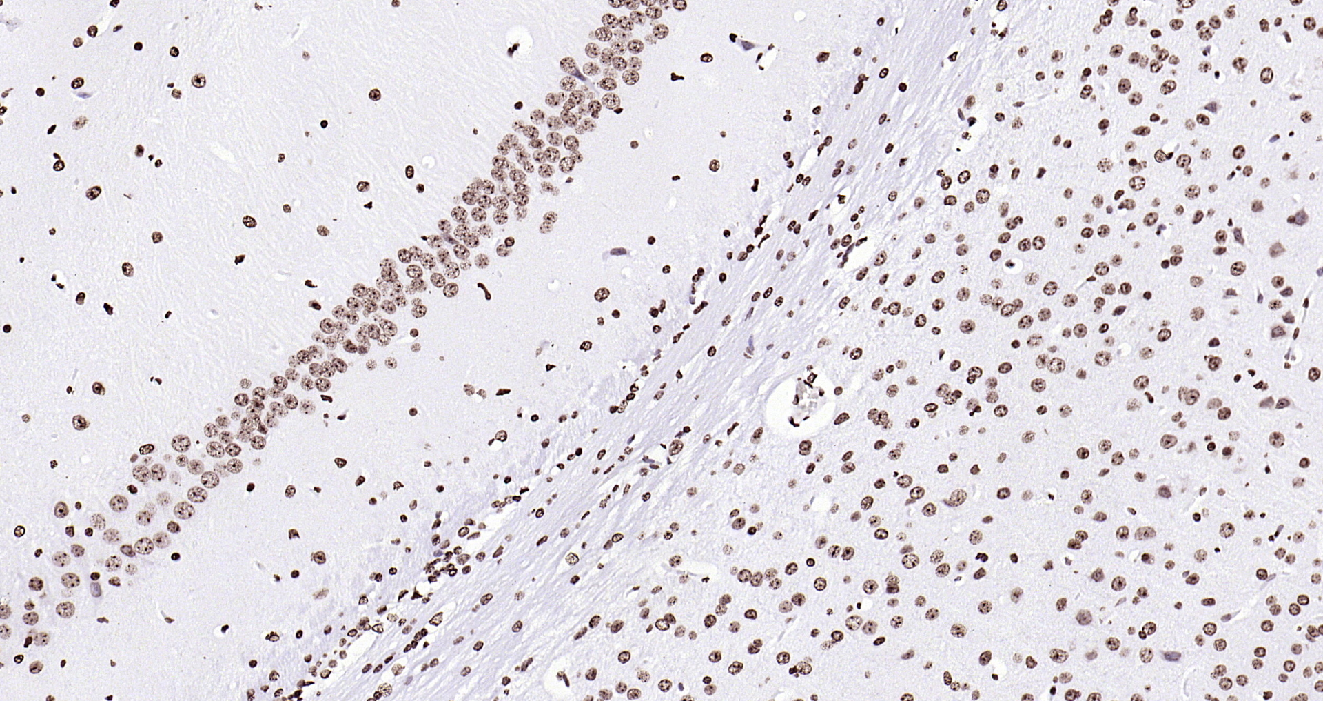 Paraformaldehyde-fixed, paraffin embedded (mouse brain); Antigen retrieval by boiling in sodium citrate buffer (pH6.0) for 15min; Block endogenous peroxidase by 3% hydrogen peroxide for 20 minutes; Blocking buffer (normal goat serum) at 37°C for 30min; Antibody incubation with (Histone H3 (Nuclear Loading Control)) Polyclonal Antibody, Unconjugated (bs-0349R) at 1:200 overnight at 4°C, followed by operating according to SP Kit(Rabbit) (sp-0023 bs-0295G-HRP 1:100) instructionsand DAB staining.