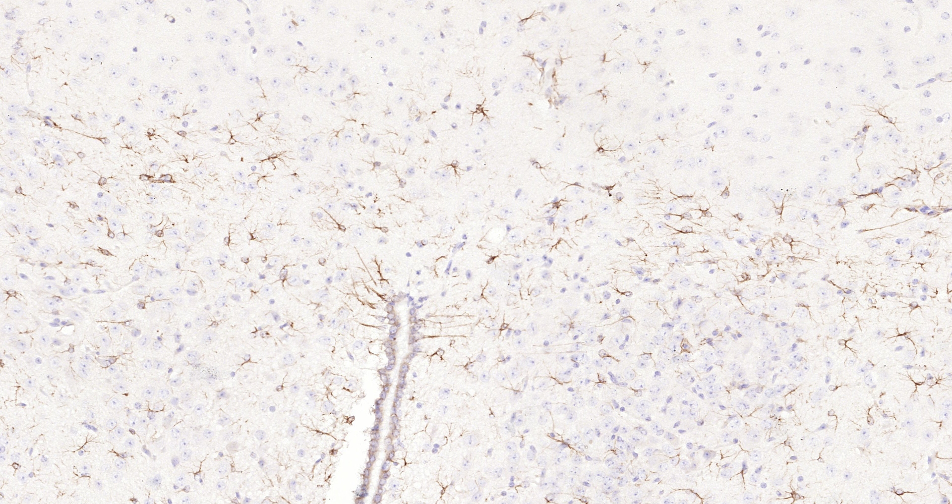 Paraformaldehyde-fixed, paraffin embedded (mouse brain); Antigen retrieval by boiling in sodium citrate buffer (pH6.0) for 15min; Block endogenous peroxidase by 3% hydrogen peroxide for 20 minutes; Blocking buffer (normal goat serum) at 37°C for 30min; Antibody incubation with (GFAP) Polyclonal Antibody, Unconjugated (bs-0199R) at 1:200 overnight at 4°C, followed by operating according to SP Kit(Rabbit) (sp-0023 bs-0295G-Bio 1:1000) instructionsand DAB staining.