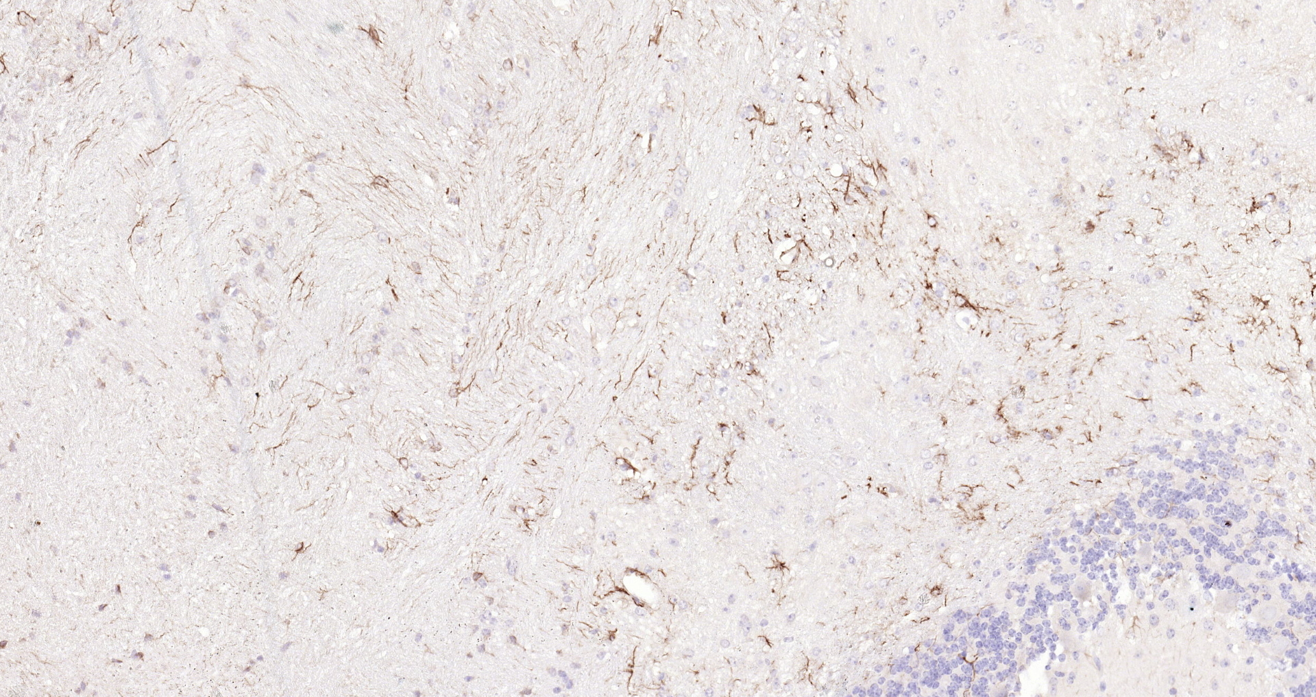 Paraformaldehyde-fixed, paraffin embedded (mouse cerebellum); Antigen retrieval by boiling in sodium citrate buffer (pH6.0) for 15min; Block endogenous peroxidase by 3% hydrogen peroxide for 20 minutes; Blocking buffer (normal goat serum) at 37°C for 30min; Antibody incubation with (GFAP) Polyclonal Antibody, Unconjugated (bs-0199R) at 1:200 overnight at 4°C, followed by operating according to SP Kit(Rabbit) (sp-0023 bs-0295G-Bio 1:500) instructionsand DAB staining.