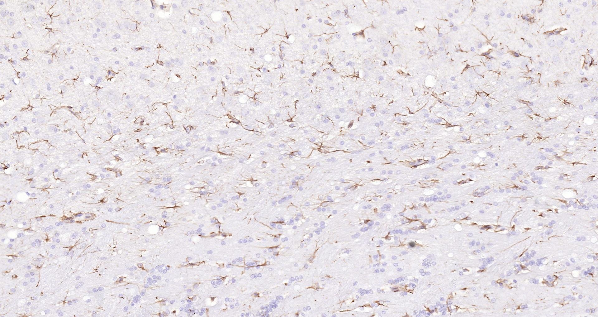 Paraformaldehyde-fixed, paraffin embedded (RAT brain); Antigen retrieval by boiling in sodium citrate buffer (pH6.0) for 15min; Block endogenous peroxidase by 3% hydrogen peroxide for 20 minutes; Blocking buffer (normal goat serum) at 37°C for 30min; Antibody incubation with (GFAP) Polyclonal Antibody, Unconjugated (bs-0199R) at 1:200 overnight at 4°C, followed by operating according to SP Kit(Rabbit) (sp-0023 bs-0295G-Bio 1:1000) instructionsand DAB staining.