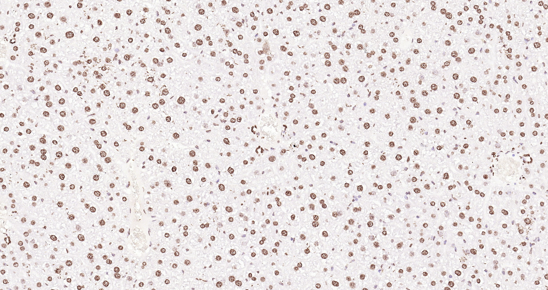Paraformaldehyde-fixed, paraffin embedded (mouse liver); Antigen retrieval by boiling in sodium citrate buffer (pH6.0) for 15min; Block endogenous peroxidase by 3% hydrogen peroxide for 20 minutes; Blocking buffer (normal goat serum) at 37°C for 30min; Antibody incubation with (Histone H3 (Nuclear Loading Control)) Polyclonal Antibody, Unconjugated (bs-0349R) at 1:200 overnight at 4°C, followed by operating according to SP Kit(Rabbit) (sp-0023 bs-0295G-Bio 1:500) instructionsand DAB staining.