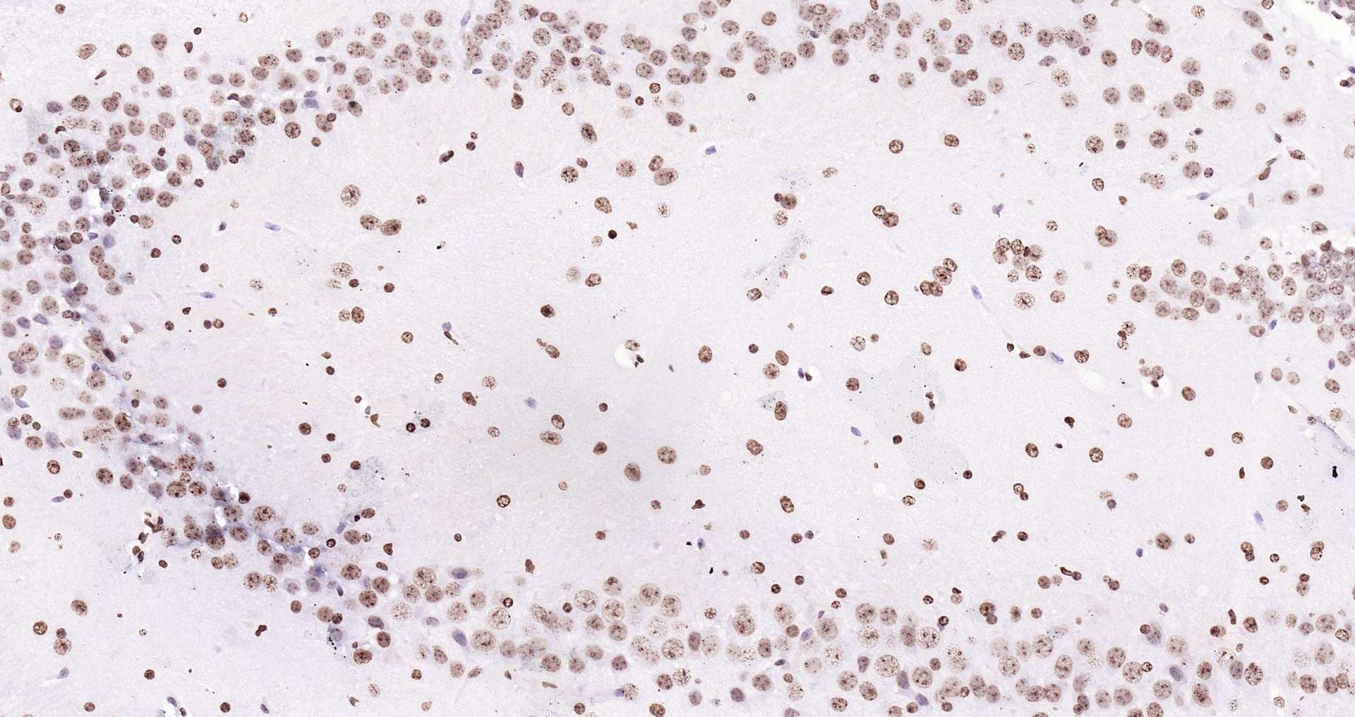 Paraformaldehyde-fixed, paraffin embedded (mouse brain); Antigen retrieval by boiling in sodium citrate buffer (pH6.0) for 15min; Block endogenous peroxidase by 3% hydrogen peroxide for 20 minutes; Blocking buffer (normal goat serum) at 37°C for 30min; Antibody incubation with (Histone H3 (Nuclear Loading Control)) Polyclonal Antibody, Unconjugated (bs-0349R) at 1:200 overnight at 4°C, followed by operating according to SP Kit(Rabbit) (sp-0023 bs-0295G-Bio 1:500) instructionsand DAB staining.