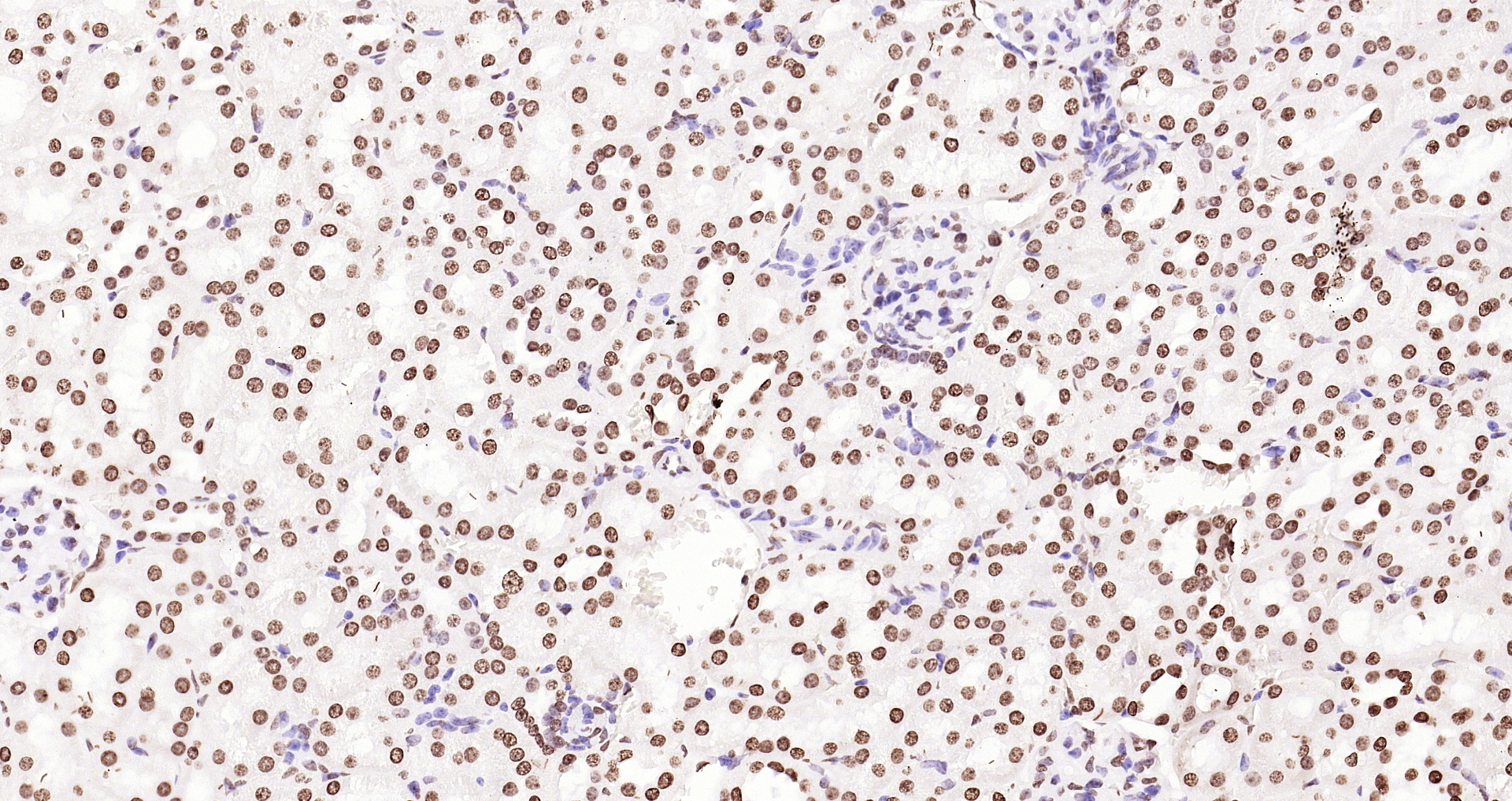 Paraformaldehyde-fixed, paraffin embedded (mouse kidney); Antigen retrieval by boiling in sodium citrate buffer (pH6.0) for 15min; Block endogenous peroxidase by 3% hydrogen peroxide for 20 minutes; Blocking buffer (normal goat serum) at 37°C for 30min; Antibody incubation with (Histone H3 (Nuclear Loading Control)) Polyclonal Antibody, Unconjugated (bs-0349R) at 1:200 overnight at 4°C, followed by operating according to SP Kit(Rabbit) (sp-0023 bs-0295G-Bio 1:500) instructionsand DAB staining.