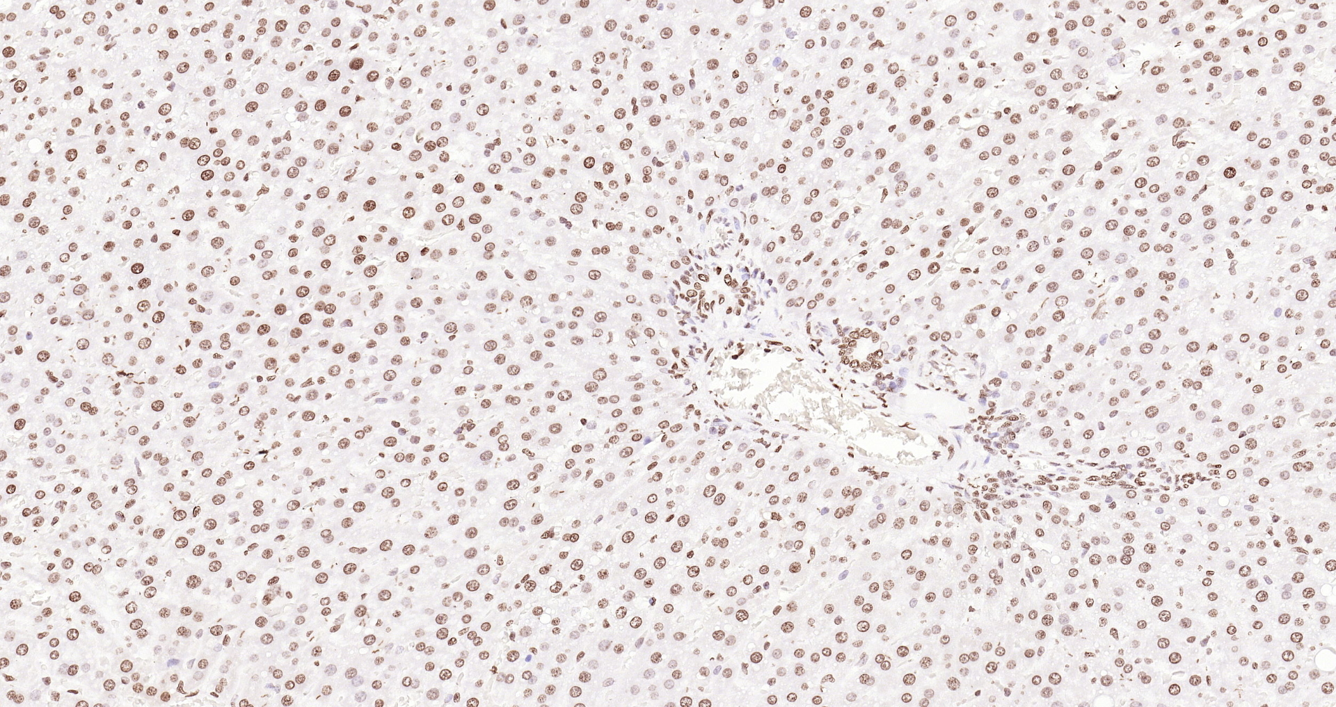 Paraformaldehyde-fixed, paraffin embedded (rat liver); Antigen retrieval by boiling in sodium citrate buffer (pH6.0) for 15min; Block endogenous peroxidase by 3% hydrogen peroxide for 20 minutes; Blocking buffer (normal goat serum) at 37°C for 30min; Antibody incubation with (Histone H3 (Nuclear Loading Control)) Polyclonal Antibody, Unconjugated (bs-0349R) at 1:200 overnight at 4°C, followed by operating according to SP Kit(Rabbit) (sp-0023 bs-0295G-Bio 1:500) instructionsand DAB staining.