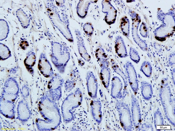 Formalin-fixed and paraffin embedded human gastric parietal cells labeled with Anti-Gastrin Polyclonal Antibody, Unconjugated (bs-1189R) followed by conjugation to the secondary antibody and DAB staining