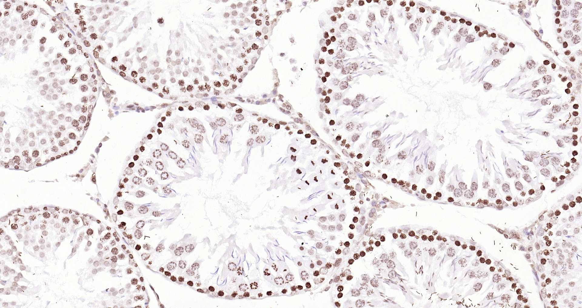 Paraformaldehyde-fixed, paraffin embedded (rat testis); Antigen retrieval by boiling in sodium citrate buffer (pH6.0) for 15min; Block endogenous peroxidase by 3% hydrogen peroxide for 20 minutes; Blocking buffer (normal goat serum) at 37°C for 30min; Antibody incubation with (Histone H3 (Nuclear Loading Control)) Polyclonal Antibody, Unconjugated (bs-0349R) at 1:200 overnight at 4°C, followed by operating according to SP Kit(Rabbit) (sp-0023 bs-0295G-Bio 1:500) instructionsand DAB staining.
