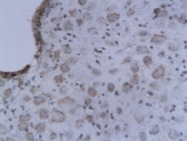 Formalin-fixed and paraffin embedded decidual tissue labeled with Anti-IL-2 Polyclonal Antibody, Unconjugated (bs-1191R)  followed by conjugation to the secondary antibody and DAB staining
