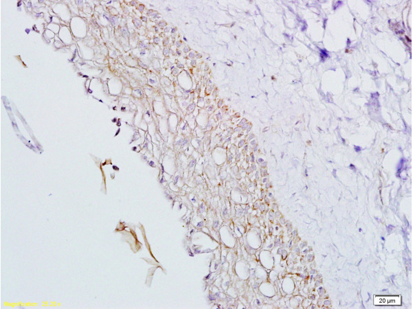 Formalin-fixed and paraffin embedded rat ovary tissue labeled with Anti-Inhibin Alpha Polyclonal Antibody, Unconjugated (bs-1032R) at 1:200, followed by conjugation to the secondary antibody and DAB staining