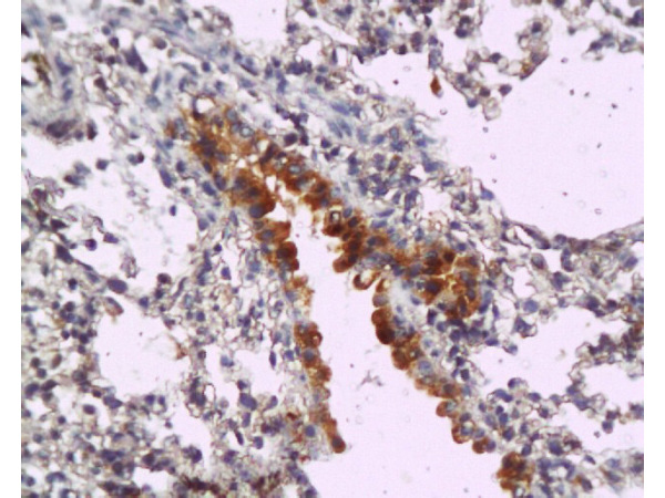 Formalin-fixed and paraffin embedded mouse lung tissue labeled with Anti-MyD88 Polyclonal Antibody, Unconjugated (bs-1047R)  at 1:200, followed by conjugation to the secondary antibody and DAB staining