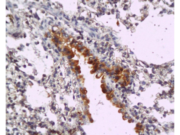 Formalin-fixed and paraffin embedded mouse lung tissue labeled with Anti-MyD88 Polyclonal Antibody, Unconjugated (bs-1047R) at 1:200, followed by conjugation to the secondary antibody and DAB staining Formalin-fixed and paraffin embedded mouse lung tissue labeled with Anti-MyD88 Polyclonal Antibody, Unconjugated (bs-1047R) at 1:200, followed by conjugation to the secondary antibody and DAB staining