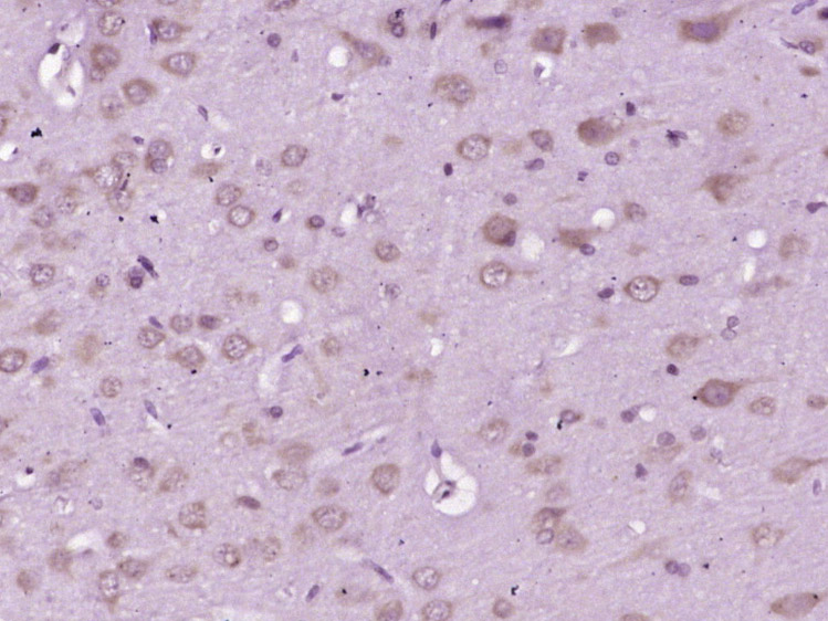 Paraformaldehyde-fixed, paraffin embedded Rat brain; Antigen retrieval by boiling in sodium citrate buffer (pH6.0) for 15min; Block endogenous peroxidase by 3% hydrogen peroxide for 20 minutes; Blocking buffer (normal goat serum) at 37°C for 30min; Antibody incubation with GRP78 Polyclonal Antibody, Unconjugated (bs-1219R) at 1:400 overnight at 4°C, DAB staining.