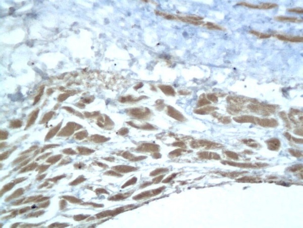 Formalin-fixed and paraffin embedded rat synovial tissue labeled with Anti-Aggrecan1 Polyclonal Antibody, Unconjugated (bs-1223R) followed by conjugation to the secondary antibody and DAB staining